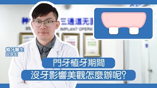 【深圳門牙植牙】門牙植牙期間，缺牙影響美觀怎麼辦呢？維港口腔連鎖沈醫生分享