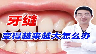 牙缝为什么变得越来越大，应该怎么办？