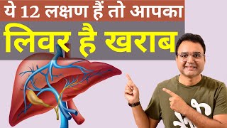 लिवर खराब होने के 12 शुरूआती लक्षण | Symptoms Of Liver Damage | by Dr Saleem Zaidi