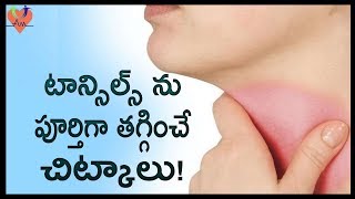 టాన్సిల్స్ ను పూర్తిగా తగ్గించే చిట్కాలు ! | Best Natural Home Remedies To Cure Tonsillitis | Arogya