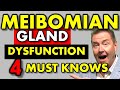 What is MEIBOMIAN GLAND DYSFUNCTION:  4 CAUSES of DRY EYE by youtube eye doctor