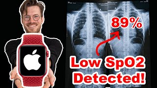 Apple Watch Scientific SpO2 Test (Oxygen Saturation Review)