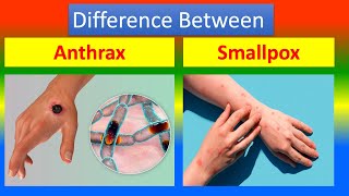 Difference between Anthrax and  Smallpox