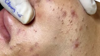 Satisfying video with Chung Vo Spa| 185