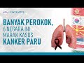 6 Negara Dengan Tingkat Kanker Paru Paru Tertinggi, Ada Indonesia?  | Hidup Sehat tvOne