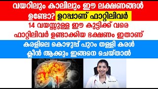 കുട്ടികൾക്ക് വരെ ഫാറ്റിലിവറിനു കാരണം ഈഭക്ഷണമാണ്,ഈ ലക്ഷണം ഉണ്ടോ എന്ന് ഇപ്പോൾ തന്നെ നോക്കു|fatty liver