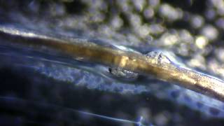 Crystals Forming On Human Hair @ 100X