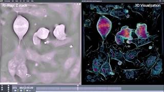 4 mESCs Mitosis synced up