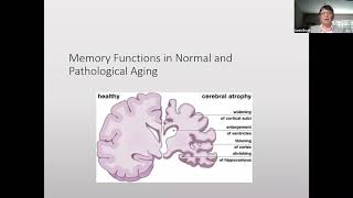 Minding Our Memory: Challenges and Training Techniques [Webinar]
