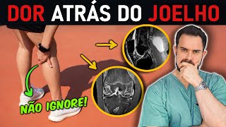 Dor Atrás do Joelho: GUIA COMPLETO! As 9 Principais Causas e como TRATAR (Aulão C/ ESPECIALISTA)