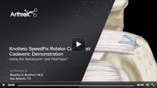 Knotless SpeedFix™ Rotator Cuff Repair Cadaveric Demonstration Using the SwiveLock® and FiberTape®