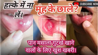 मूंह का कैंसर केसे होता है?mouth ulcers?mooh ke chhale?