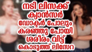 നടി ലിസക്ക് ക്യാൻസർ ഡോക്ടർ പോലും കരഞ്ഞു പോയി ശരീരം വിട്ട് കൊടുത്ത് ലിസേറ