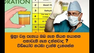 ඔබේ මුත්‍රා වල වර්ණය කුමක්ද? මෙන්න ඒ අනුව ඔබ ගැන වටිනා හෝඩුවාවක් -  urine color says about you