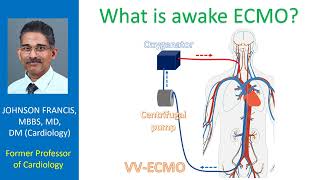 What is awake ECMO?