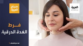 صباح العربية | ما هو فرط نشاط الغدة الدرقية؟