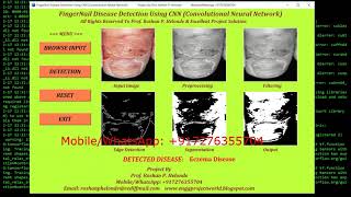 FingerNail Disease Detection Using CNN | Python Project Source Code Final Year Projects #SourceCode