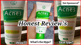 Mentholatum Acne Creamy Face Wash ( HONEST REVIEW'S )✨