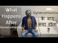 Gynecomastia Recovery - explained by a patient himself in Hindi.Surgery at Rejuva Aesthetica Gujarat