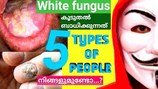 എന്താണ് വൈറ്റ് ഫംഗസ്?5 types of people commonly affected by white fungus|Symptoms of white fungus