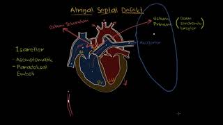 Atriyal Septal Defekt (Fen Bilimleri) (Sağlık ve Tıp)