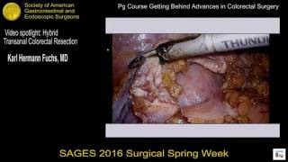 Video spotlight: Hybrid transanal colorectal resection