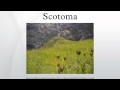 Scotoma