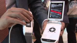 RSNA 2014 Editor's Choice of the Most Innovative New Technology