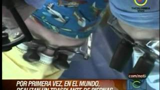 En España se realizó el primer trasplante de piernas en el mundo