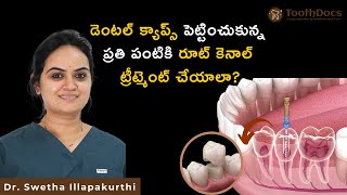 డెంటల్ క్యాప్స్ పెట్టించుకున్న ప్రతి పంటికి రూట్ కెనాల్ ట్రీట్మెంట్ చేయాలా?  Tooth Docs Hyderabad