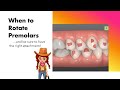 Invisalign ClinCheck - The FEW times to rotate premolars and HOW!