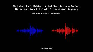 2508.19060 - No Label Left Behind: A Unified Surface Defect Detection Model