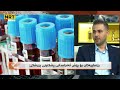 رێنماییەکان بۆ پێش ئەنجامدانی پشکنینی پزیشکی