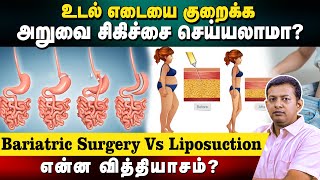 உடல் எடையை குறைக்க அறுவை சிகிச்சை செய்யலாமா? Bariatric Surgery Vs Liposuction - என்ன வித்தியாசம்?