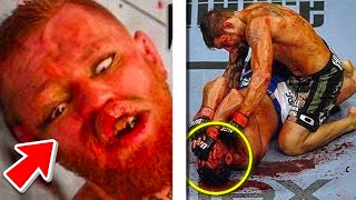 TOP 10 WORST MMA INJURIES OF ALL TIME