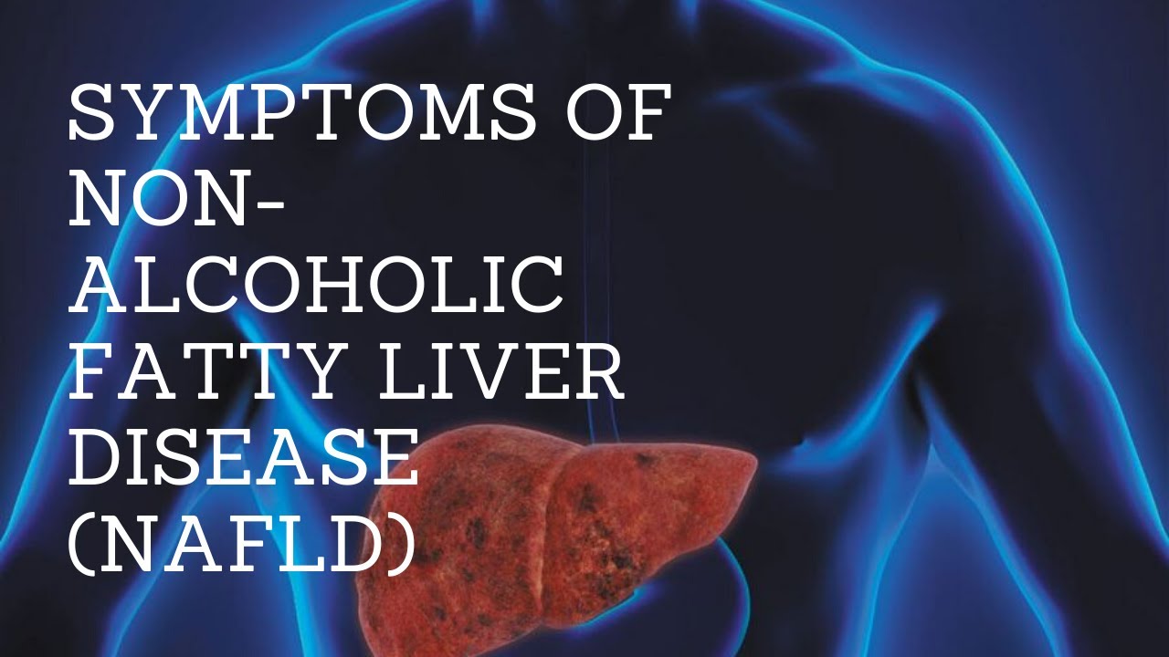 Symptoms Of Non-Alcoholic Fatty Liver Disease (nafld) - YouTube