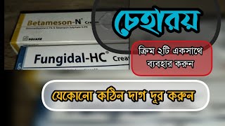 Betameson N Cream \u0026 Fungidal HC Cream |ক্রিম দুটি চেহারা পরিষ্কার করার জন্য জাদুর মত কাজ করে