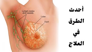 طرق علاج سرطان الثدي