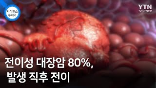 전이성 대장암 80%, 발생 직후 전이 / YTN 사이언스