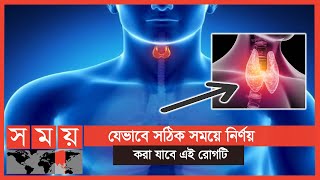 থাইরয়েড ব্যাধি কী? জানুন বিস্তারিত | Thyroid Disease | Medical Science | Somoy TV