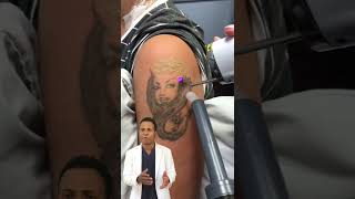 Eliminación de tatuaje con láser | Dr. Suárez Collado