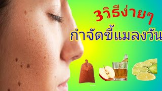 3วิธีกำจัดขี้แมลงวันง่ายๆ ด้วยวิธีธรรมชาติ|How R U