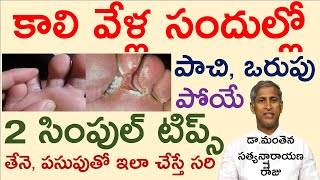 కాలి వేళ్ల సందుల్లో పాచి, ఒరుపు పోయే సింపుల్ టిప్స్ |Manthena Satyanarayana Raju Videos |GOOD HEALTH