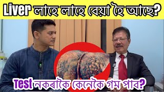 ডিঙিত ক’লা দাগ আছে নেকি? শৰীৰত ৰঙা ৰঙা গুটি  ওলাই নেকি? Liver টো কিমান বেয়া হৈছে এবাৰতে গম পাওক