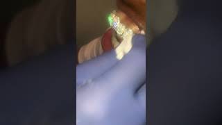 Houston rapper Sack gets permanent Diamond teeth