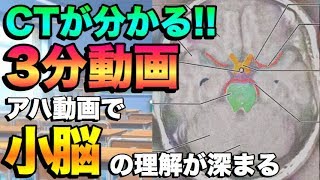 【脳】３分間でCTがわかる‼小脳・橋メイン【PT・OT国家試験対策】