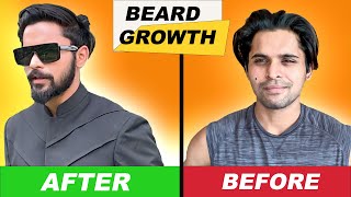 How to GROW BEARD FASTER| FIX PATCHY BEARD Naturally| Facial Hair | Thick Beard | Beard oil? | Hindi