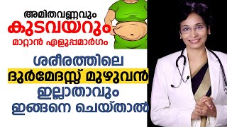 അമിതവണ്ണവും കുടവയറും മാറ്റാൻ എളുപ്പമാർഗം | Obesity - Weight Reduction - Easy Way | Arogyam