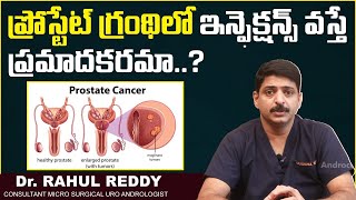 ప్రోస్టేట్ గ్రంథిలో ఇన్ఫెక్షన్ | Causes Of Prostatitis in Telugu | Dr Rahul Reddy | Androcare Clinic