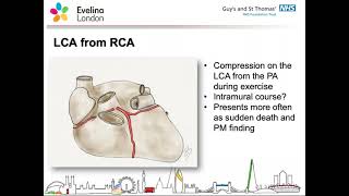 Cardiology - Chest Pains Palpitations Syncope - Dr H Bellsham Revell - 17Nov2020